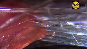 Muscle fibers